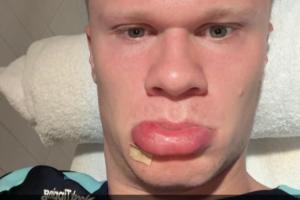 开云登录网址入口-盛世美颜哈兰德早起撅香肠嘴晒自拍：早上好